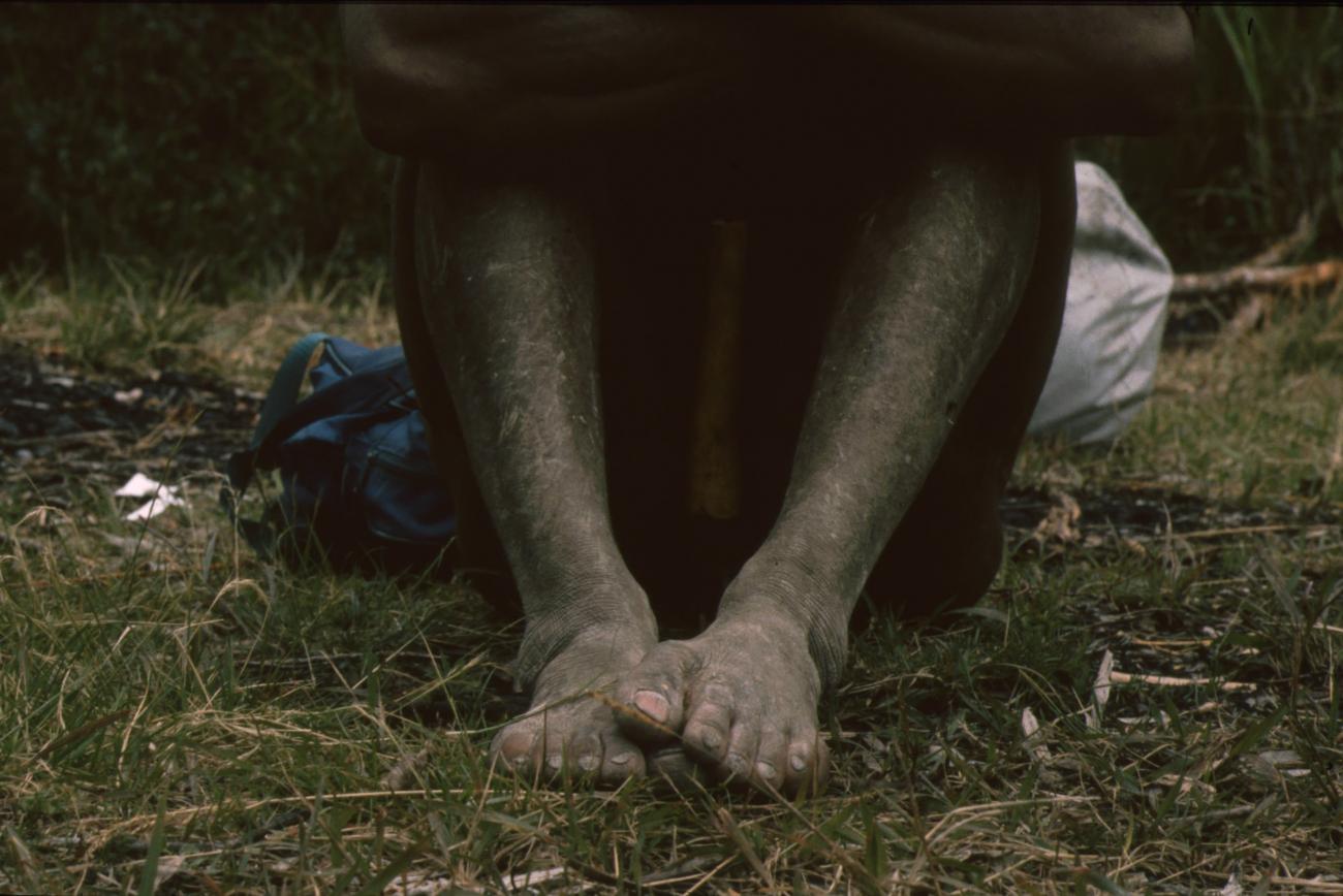 BD/166/206 - 
Feet on the grass
