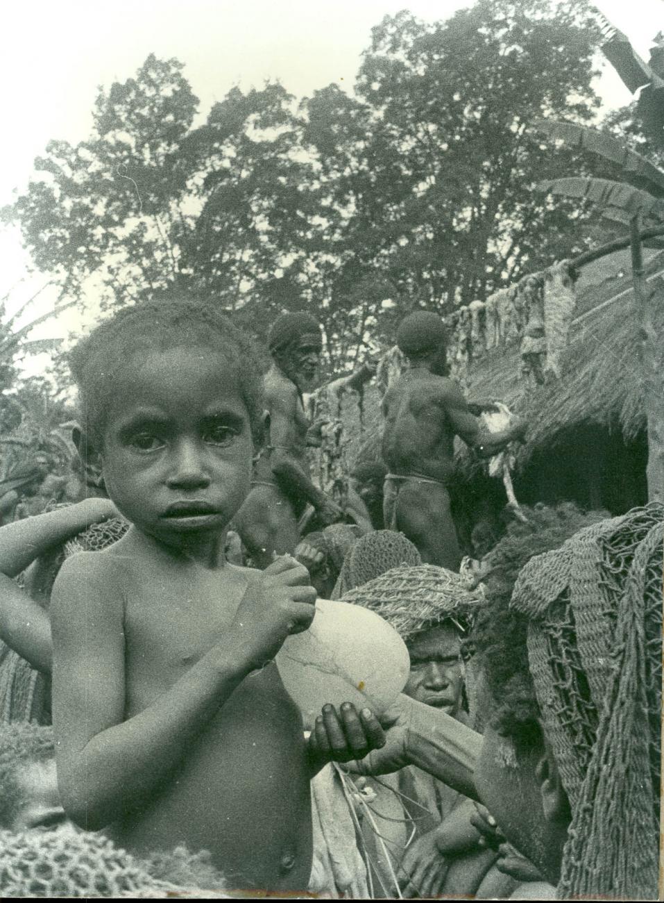 BD/40/23 -
Child with pig blatter