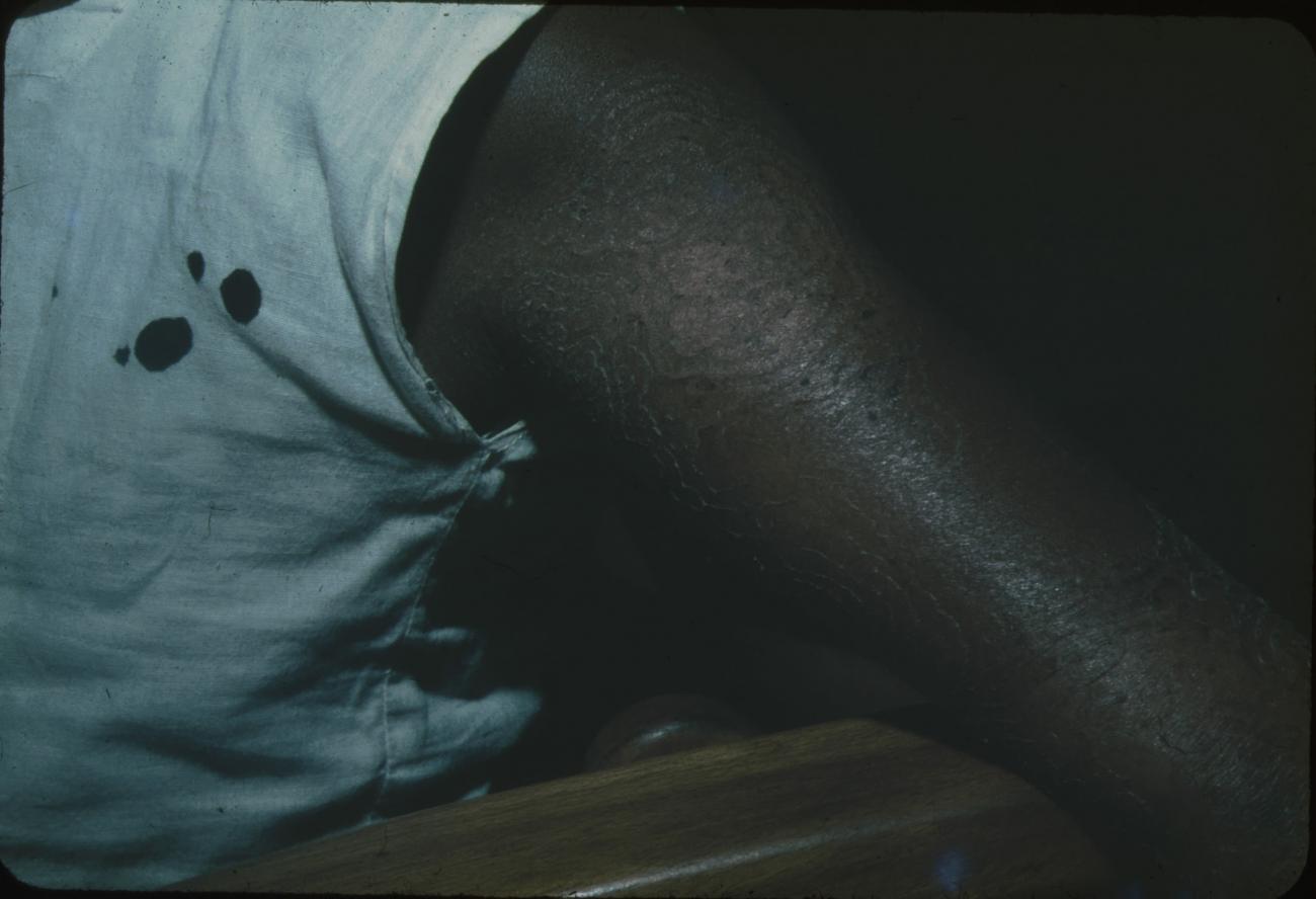 BD/171/1770 -
Arm