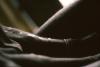 BD/166/76 Compositie van bovenbeen en arm
