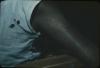 BD/171/1770 Arm